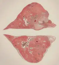 Liver Health and Antioxidants: A Clear Guide to Nutrition, Supplements, and Safety